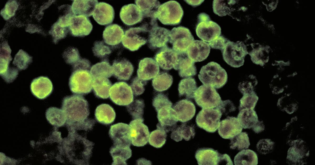 Brain-eating amoeba infects water supply in Texas