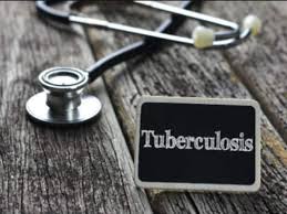 Door-to-door testing for TB in Maharashtra from December 1